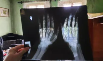 Dwór w pisarzowicach - zdjęcie 2/4