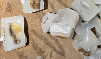 Prosektorium